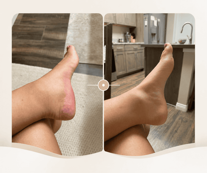 Drainage Drops - Depuff eyes & balance water retention